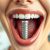Implantologia stomatologiczna – co warto wiedzieć o implantach zębowych?