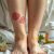 Choroby skóry nóg: objawy, leczenie i domowe sposoby na świąd
