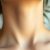 Przebarwienia na szyi: przyczyny, pielęgnacja i skuteczne metody zapobiegania